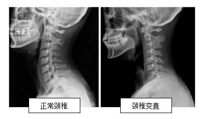 QQ截图20190307094528